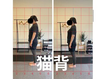 カワル整体 長嶺院/猫背