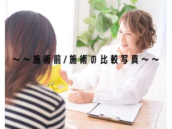 美活ラボ(美活LABO)/ビフォーアフター