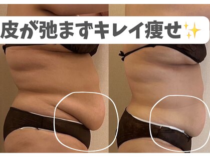 ヨサパーク リュールカジョ(YOSA PARK LUEUR Kajo)の写真