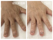 キレイテ 上野店/50代/7回目【ハンドケア稲荷町】