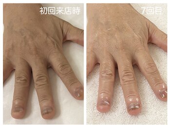 キレイテ 上野店/50代/7回目【ハンドケア稲荷町】
