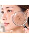 アトワ 新宿店(ATOI)の写真/気になるシミ・毛穴を徹底ケア！ATOI 結果重視の美肌ケア×癒しのリンパで大人の素肌を美しく！