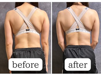 こもれび/1回の施術でこんなに変化が !!