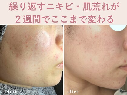 エアル(earu.)の写真