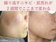 エアル(earu.)の写真