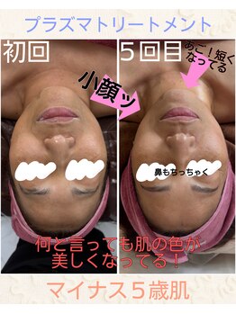 カシェボーテ(CACHE BEAUTE)/フェイシャル