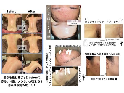 ヴェヌスタ(VENUSTA)の写真