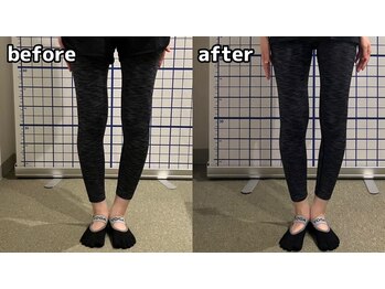 マックストレーニングラボ(MAX TRAININGLABO)/O脚・X脚も美脚に!