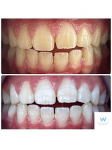 ホワイトニングショップ 奈良生駒店/清潔感を