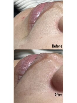 アールネイルズ(R Nails)/MinMin Wax脱毛