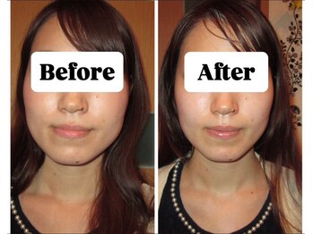 マンマ ジュンナ/【浜松/小顔/小顔矯正】