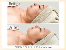 韓国最新小顔マシン☆潤いを与えながら理想のフェイスラインに◎