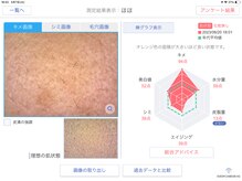 Rr.FACIAL郡山店　毛穴×たるみ×小顔専門店/