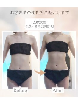 アンドユー(&U)/