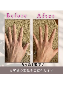 サバス(Sabbath)/ハンドケアエステ