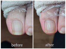 爪切り屋 足楽/足爪の理想の形