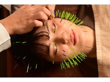 マーキュリー(Mercury)の雰囲気(沖縄唯一100本鍼で圧倒的変化を実感しませんか?)