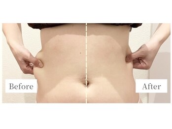 アルメリア(Armeria)/ウエスト【結果写真】