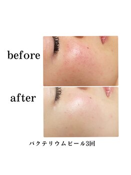 エステティックレイビス 弘前店(RAYVIS)/