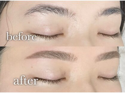 フランク(Frank)の写真