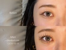 プラス サード(Plus 3rd)/バインドロック