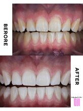 エクシアホワイトニング 王寺店/