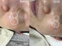 ルンルン(run run)/