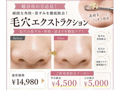 エムベル 越谷レイクタウン店(M belle)の写真