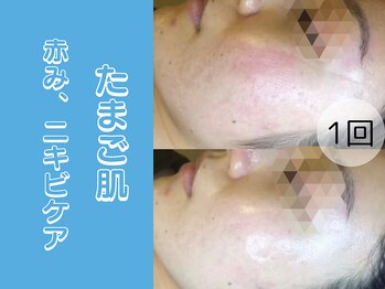 ポラリス(Polaris)/