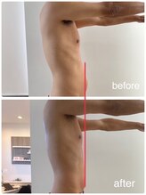 ルセヴィア(LUCEVIA)/痩身エステ（メンズ）