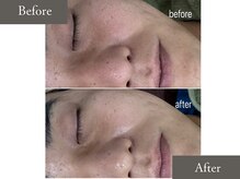 スキニティ(Skinity)/メンズもご予約承っております＊