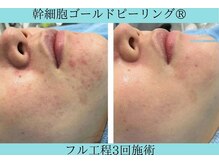 リメイククリニカルビューティー(Remake clinical beauty)/