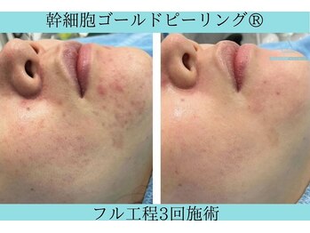 リメイククリニカルビューティー(Remake clinical beauty)/