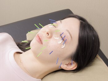 目黒不動前はりきゅう接骨院の写真/【初回限定全身鍼+マッサージ￥6500→￥2980】お悩み改善サロン！その場しのぎではない本質的なケア◎