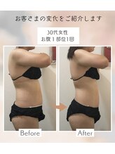 アンドユー(&U)/