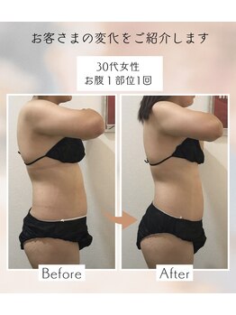 アンドユー(&U)/