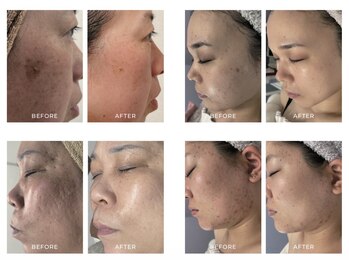 韓国肌管理Naturry【6/5 OPEN】の写真/厚塗りファンデ卒業!結果までショートカット!最短で変化を感じられる「韓国肌質管理」