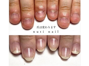nuti nail【ヌチネイル】【6/25 NEW OPEN】の写真/【深爪/卒業宣言】ブライダル爪育コース有☆