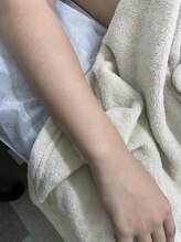 ナノハナ/鹿沼市の全身脱毛のナノハナ