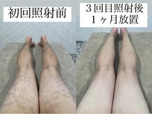 テンパ ビューティー(+10%beauty)/効果写真