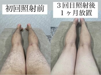 テンパ ビューティー(+10%beauty)/効果写真