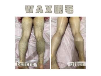 レヴィート(Revept)/【ワックス脱毛】