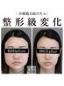 小顔頭蓋骨矯正＋リンパケア4回コース￥30,800→￥22,800 所用時間60分