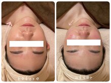 ホワイトサロンファミリア(whitesalon familia)/小顔コルギ＋ACトリートメント