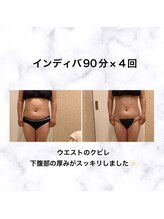 セレー(SELENE)/しかく