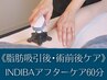 《術前・術後ケア/脂吸後の拘縮改善/DT短縮》インディバアフターケア　60分