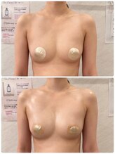 ルナグランデ 心斎橋店(Luna grande.)/本物の脂肪を増やします