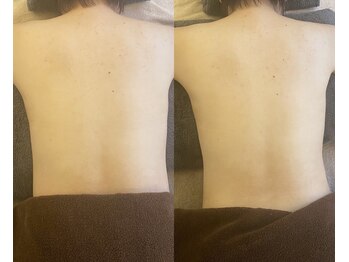 モンラパン(Mon.Lapin.)/深部リンパマッサージ