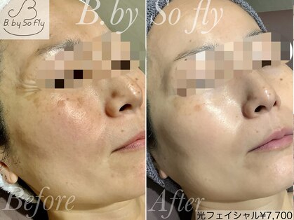 ビードット バイ ソーフライ(B.by So fly)の写真