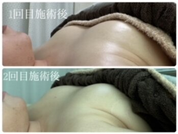 エクラニーク(Eclanique)/ぐんぐん育つ！【美バストケア】